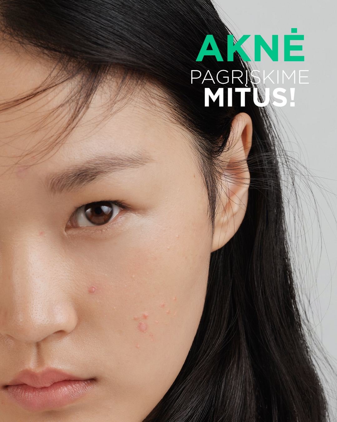 Mitai apie aknę