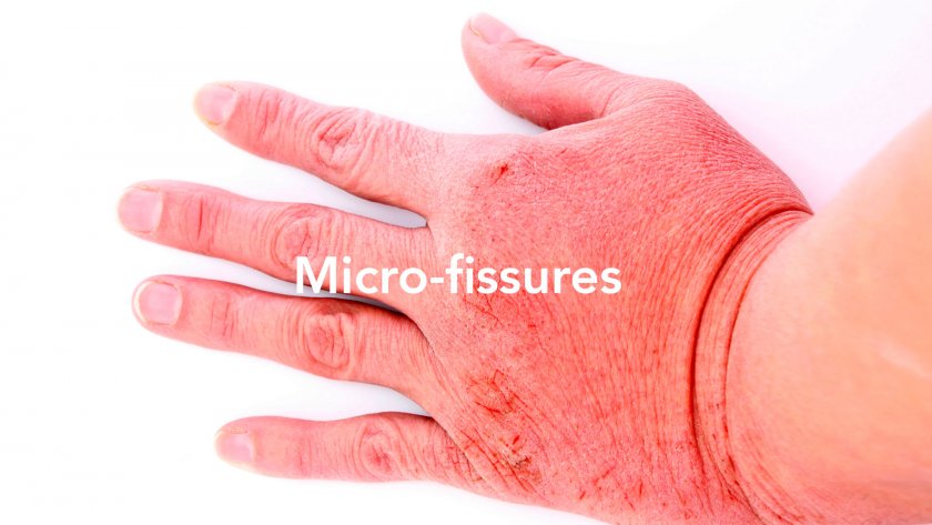Pathologies of damaged hands