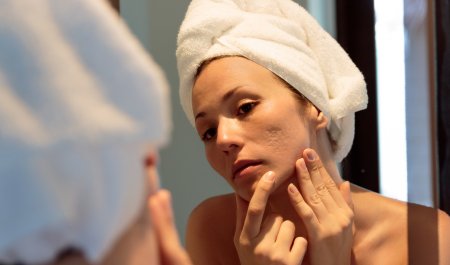 Bioderma - Adult with acne