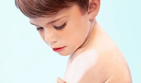 Berniukas tepasi emolientą