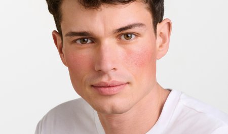 Vyras su paraudusiais skruostais