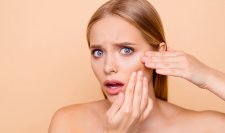 Bioderma - Moteris, turinti aknę Bioderma - Moteris, turinti aknę