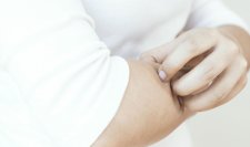 Gyvenimas turint atopišką odą 