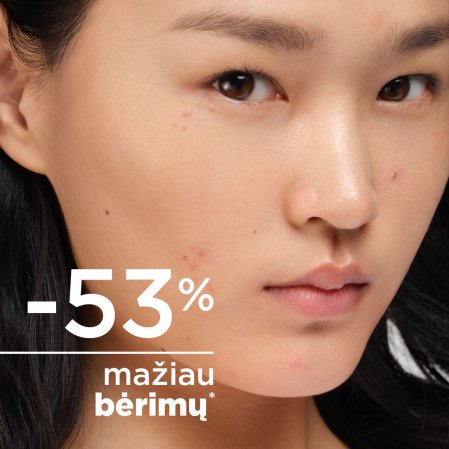 -53% mažiau bėrimų