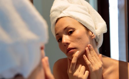 Bioderma - Adult with acne