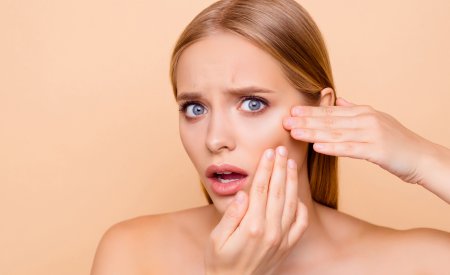 Bioderma - Moteris, turinti aknę Bioderma - Moteris, turinti aknę