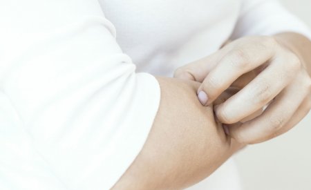 Gyvenimas turint atopišką odą Gyvenimas turint atopišką odą