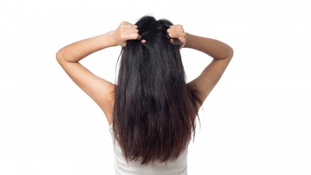 itchy hair itchy hair