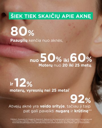 Šiek tiek skaičių apie aknę Šiek tiek skaičių apie aknę