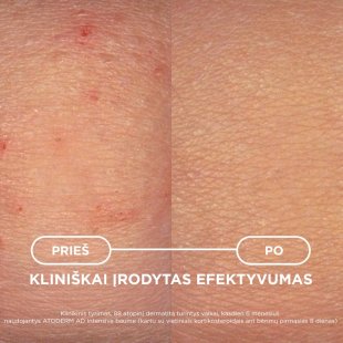 Kliniškai įrodytas efektyvumas
