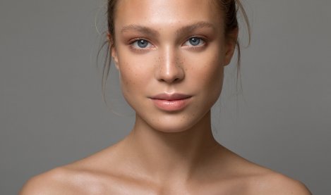 Moteris turinti hiperpigmentuotą odą